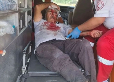إصابات في اعتداء للمستوطنين على مسيرة سلمية بمسافر يطا
