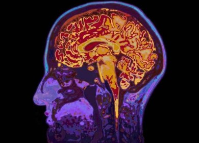 دراسة أمريكية: كوفيد-19 يزيد من خطر التعرض لإصابات دماغية طويلة الأمد
