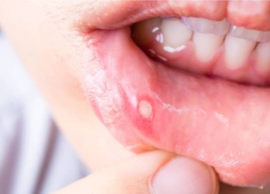 "الصحة العالمية": أمراض الفم تصيب ما يقرب من نصف البشرية