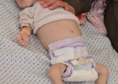 بسبب المجاعة: وفاة طفلة في مدينة غزة