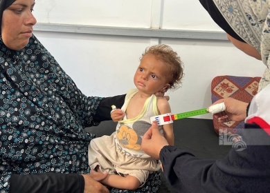 الحمى الشوكية تفتك بالأطفال في مجمع ناصر الطبي بخان يونس