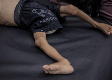 ثلاث وفيات بمتلازمة "غيلان باريه" في غزة وسط تحذير من كارثة صحية