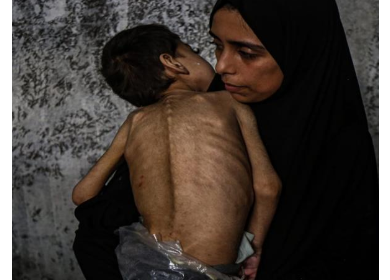 4 وفيات نتيجة المجاعة وسوء التغذية خلال الـ24 ساعة الماضية في قطاع غزة