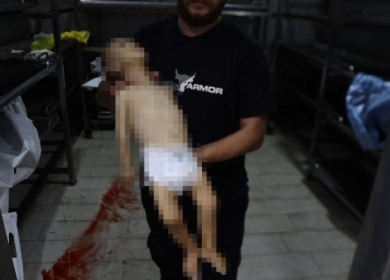 مجاعة غزة: أطباء ألمانيا يدقّون ناقوس الخطر ويدعون لتحرك عاجل