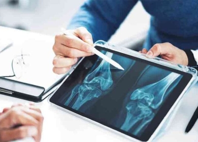 اكتشاف طبي هام قد يُعالج هشاشة العظام