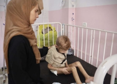 الطفلة مي.. “وردة” أذوى التجويع الإسرائيلي جسدها في غزة